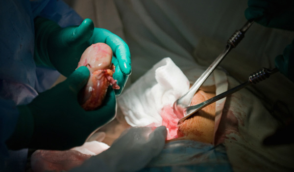 illegale-organtransplantation