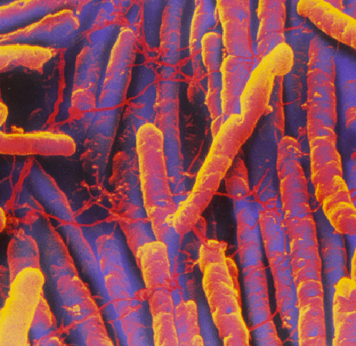 Clostridium-difficile