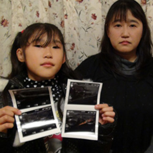 fukushima-kinder-schilddruesenkrebs